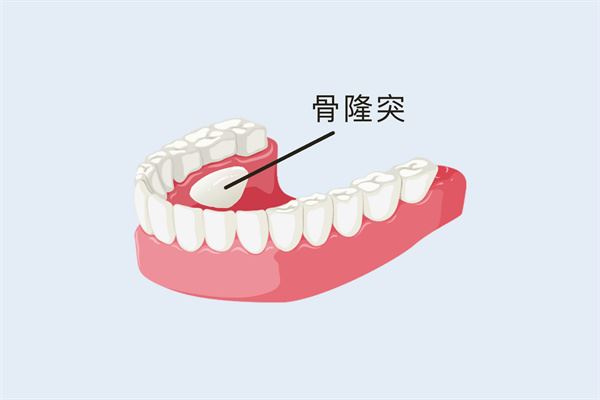 鼻内镜检查过程视频