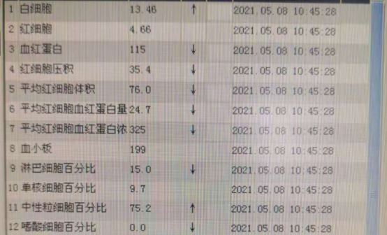 大人发烧38.9℃严重吗