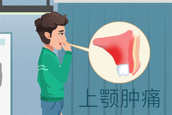 腰椎间盘突出怎么冶