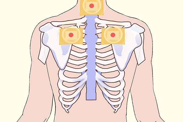 心绞痛疼痛位置