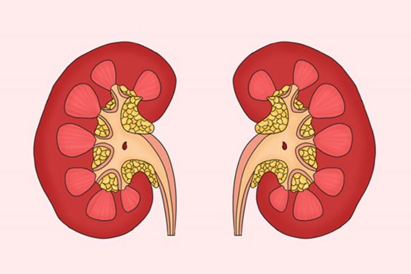 腰椎间盘突出能顺产吗