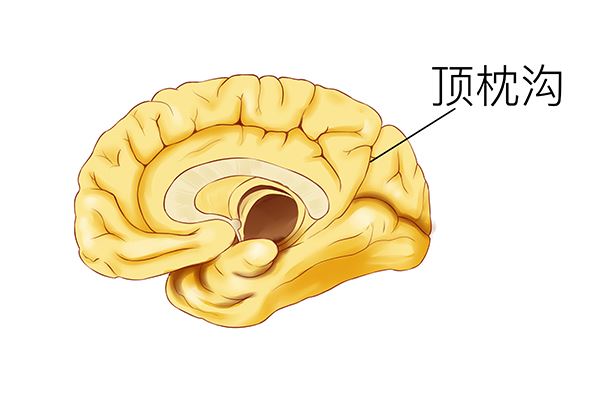 糖尿病能吃什么主食？