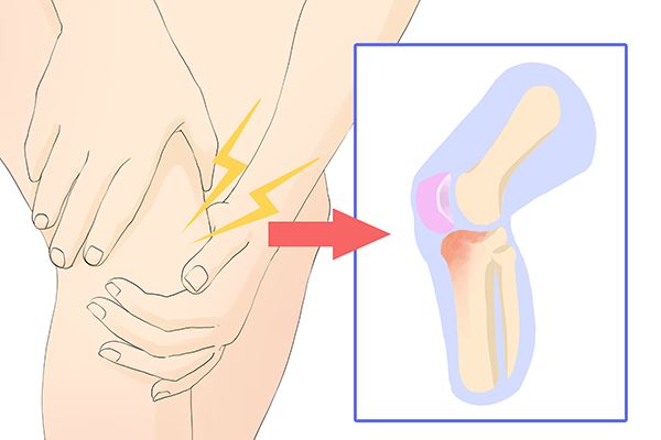 膝盖嘎嘣响是怎么回事