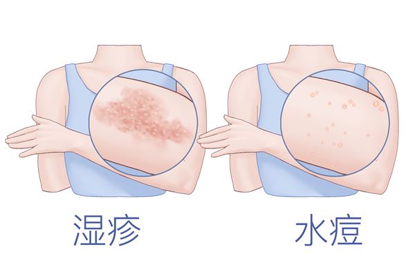 大人发烧38.9℃严重吗